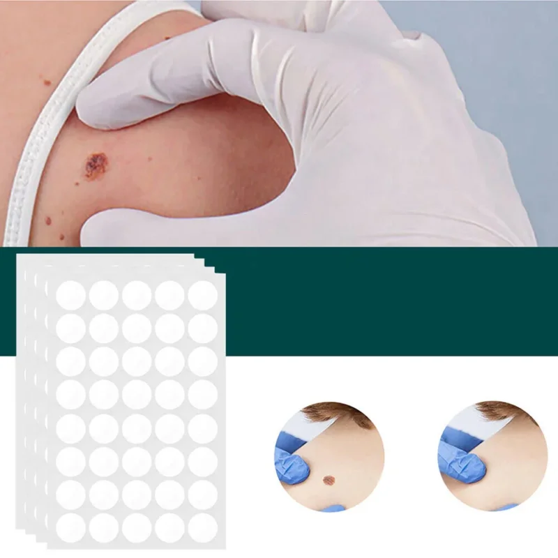 SkinClear - Pflaster zur Entfernung von Flecken und Warzen Karnz